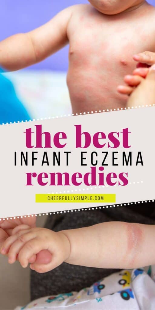 the best infant eczema remedies Pinterest pin