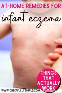 at-home remedies for infant eczema Pinterest pin