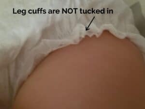 picture showing leg cuffs of diaper are not tucked in