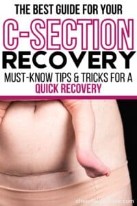 tips and tricks for a quick C-section recovery Pinterest pin